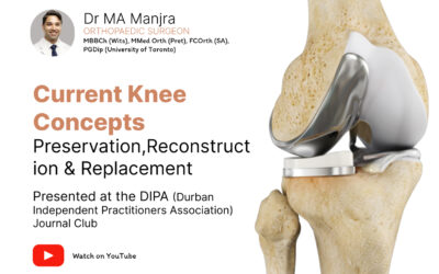Current Knee Concepts