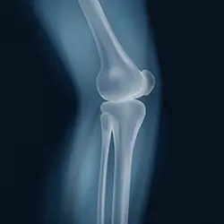 Knee-X-ray-orthopaedic-surgeon-icon-250wh